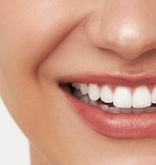 Close-up of a bright, natural smile